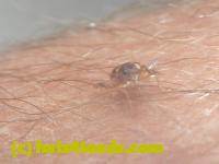 /home//u458753944/public_html/sourcegallery//////////////Insects and small critters/beetles (Coleoptera)/P1140147.JPG